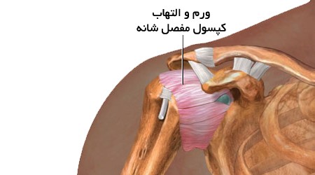 مفاصل