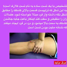 کندرومالاسی یا نرمی کشکک